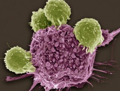 Как развивается рак в организме человека?